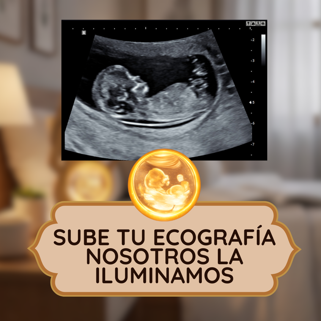 Lámpara Personalizada de Ecografía